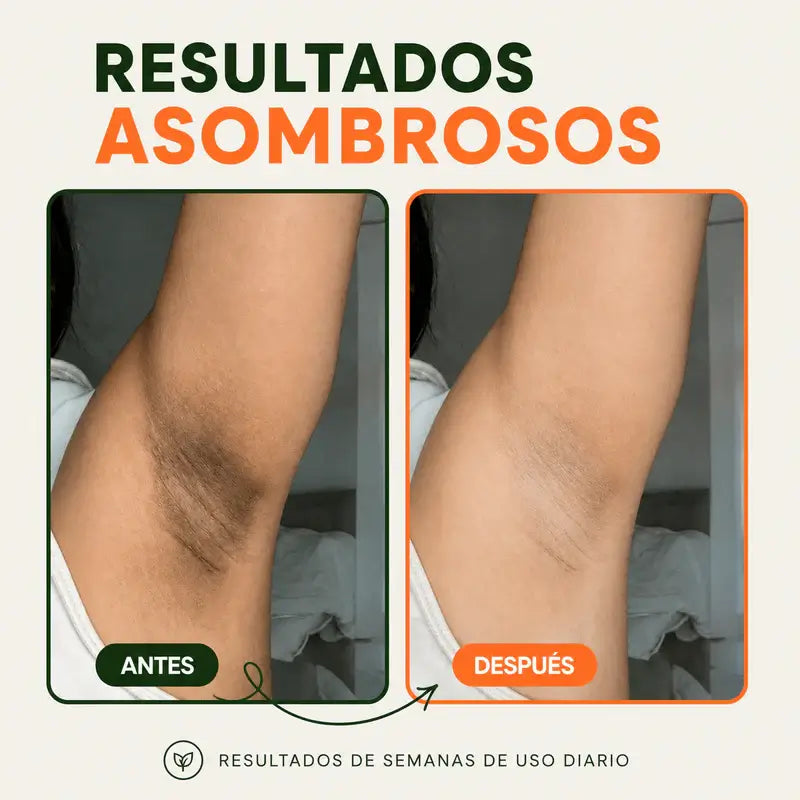 ALMOHADILLAS EXFO Y DESPIG-JIYU
